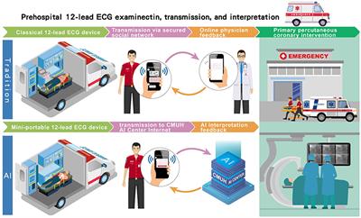 Artificial intelligence-assisted remote detection of ST-elevation myocardial infarction using a mini-12-lead electrocardiogram device in prehospital ambulance care